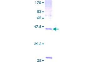 VSNL1 Protein (AA 1-191) (GST tag)