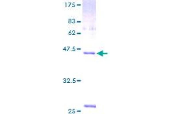 VSNL1 Protein (AA 1-191) (GST tag)