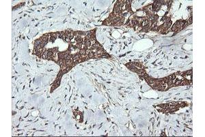 Image no. 1 for anti-Dynamin 1-Like (DNM1L) antibody (ABIN1497870) (Dynamin 1-Like antibody)