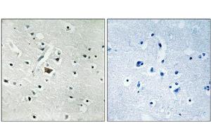 Immunohistochemical analysis of paraffin-embedded human brain tissue using PLD2 (Phospho-Tyr169) antibody (left)or the same antibody preincubated with blocking peptide (right). (Phospholipase D2 antibody  (pTyr169))