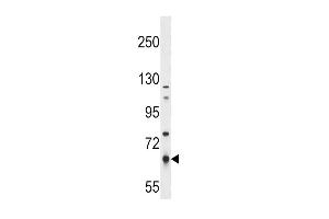 PKLR Antibody (S8) (ABIN391050 and ABIN2841209) western blot analysis in NCI- cell line lysates (35 μg/lane). (PKLR antibody  (N-Term))