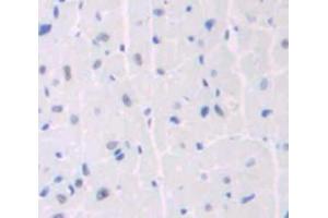 Used in DAB staining on fromalin fixed paraffin- embedded heart tissue (ANKRD1 antibody  (AA 1-319))