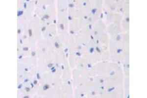 Used in DAB staining on fromalin fixed paraffin- embedded heart tissue (ANKRD1 antibody  (AA 1-319))
