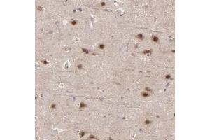 Immunohistochemical staining of human cerebral cortex with BAIAP2L2 polyclonal antibody  shows strong nuclear and cytoplasmic positivity in neuronal cells at 1:50-1:200 dilution.