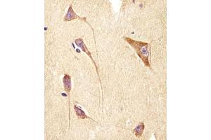 (ABIN6244245 and ABIN6578502) staining GNG2 in human brain tissue sections by Immunohistochemistry (IHC-P - paraformaldehyde-fixed, paraffin-embedded sections). (GNG2 antibody  (AA 19-52))