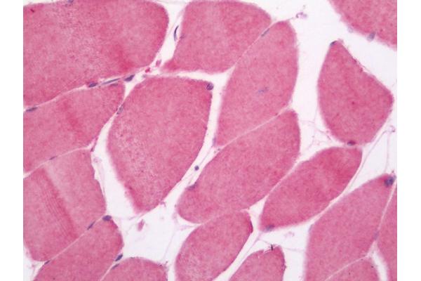 MAGMAS antibody  (HRP)