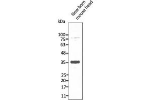 Western Blotting (WB) image for anti-Neuropeptide Y Receptor Y2 (NPY2R) (C-Term) antibody (ABIN7273070) (NPY2R antibody  (C-Term))