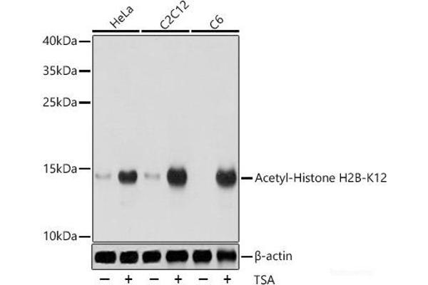 Histone H2B antibody  (acLys12)