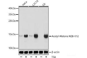 Western blot analysis of extracts of various cell lines using Acetyl-Histone H2B-K12 Polyclonal Antibody at dilution of 1:1000. (Histone H2B antibody  (acLys12))