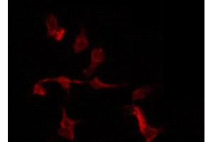 ABIN6274212 staining COLO205 by IF/ICC. (HMGB2 antibody  (Internal Region))