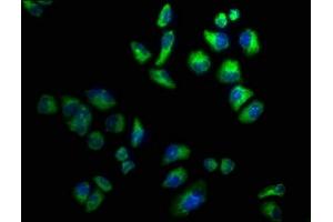 Immunofluorescence staining of Hela cells with ABIN7142963 at 1:100, counter-stained with DAPI. (CHRND antibody  (AA 334-471))