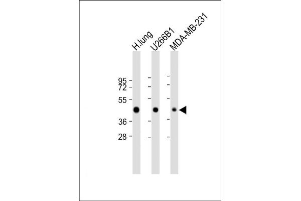 HLA-F Antikörper  (AA 172-198)