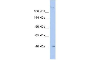 WB Suggested Anti-KIF1A Antibody Titration:  0. (KIF1A antibody  (N-Term))
