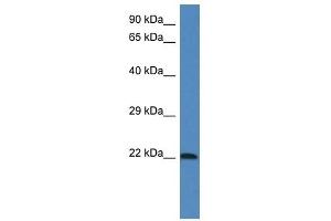 Western Blot showing 1110067D22Rik antibody used at a concentration of 1. (GRP antibody  (Middle Region))