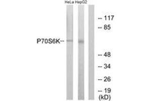 Western blot analysis of extracts from HeLa/HepG2, using p70 S6 Kinase (Ab-371) Antibody. (RPS6KB1 antibody  (AA 337-386))