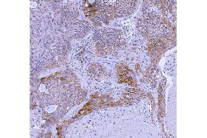 IHC analysis of WDR44 using anti-WDR44 antibody (ABIN7600394). (WDR44 antibody  (AA 188-913))