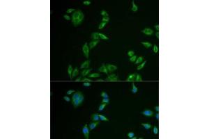 Immunofluorescence analysis of U2OS cells using MLANA Polyclonal Antibody (MLANA antibody)