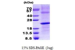 Image no. 1 for Immunoglobulin lambda-Like Polypeptide 1 (IGLL1) protein (His tag) (ABIN1098784) (IGLL1 Protein (His tag))