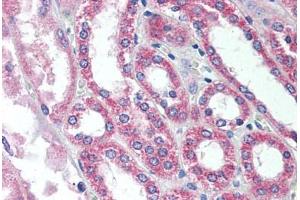 Human Kidney (formalin-fixed, paraffin-embedded) stained with SIRT7 antibody ABIN297655 at 5 ug/ml followed by biotinylated goat anti-rabbit IgG secondary antibody ABIN481713, alkaline phosphatase-streptavidin and chromogen. (SIRT7 antibody  (AA 35-51, AA 361-377))