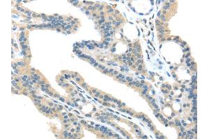 Immunohistochemistry (IHC) image for anti-Vacuolar Protein Sorting 36 (VPS36) antibody (ABIN5959966) (VPS36 antibody)