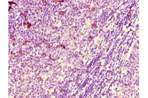 Immunohistochemistry of paraffin-embedded human lymph node tissue using ABIN7150983 at dilution of 1:100