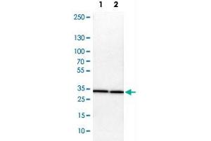 Western Blot analysis of Lane 1: NIH-3T3 cell lysate (mouse embryonic fibroblast cells) and Lane 2: NBT-II cell lysate (Wistar rat bladder tumor cells) with ARPC2 polyclonal antibody . (ARPC2 antibody)