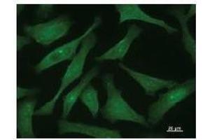 Immunostaining analysis in HeLa cells. (CTCF antibody)