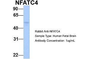 Host:  Rabbit  Target Name:  NFATC4  Sample Type:  Human Fetal Brain  Antibody Dilution:  1.