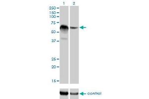Western blot analysis of RBM5 over-expressed 293 cell line, cotransfected with RBM5 Validated Chimera RNAi (Lane 2) or non-transfected control (Lane 1).