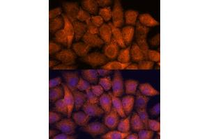 Immunofluorescence analysis of HeLa cells using RP antibody (ABIN7270101) at dilution of 1:100. (RPAP3 antibody  (AA 17-241))