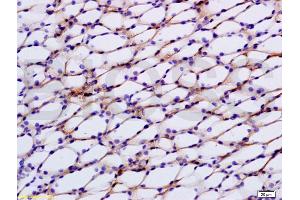 Formalin-fixed and paraffin embedded rat kidney tissue labeled with Anti-STAT2 Polyclonal Antibody, Unconjugated (ABIN738246) at 1:200 followed by conjugation to the secondary antibody, (SP-0023), and DAB staining (STAT2 antibody  (AA 151-250))