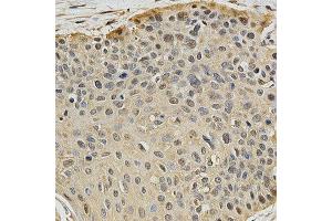 Immunohistochemistry (IHC) image for anti-Proteasome (Prosome, Macropain) Subunit, beta Type, 9 (Large Multifunctional Peptidase 2) (PSMB9) (AA 1-219) antibody (ABIN3022518) (PSMB9 antibody  (AA 1-219))