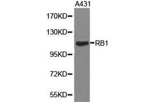 Western Blotting (WB) image for anti-Retinoblastoma 1 (RB1) antibody (ABIN1874557) (Retinoblastoma 1 antibody)