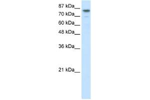 WB Suggested Anti-SMARCA3 Antibody Titration:  2.