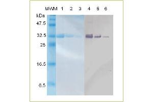 SDS-PAGE and Western blot analysis of human recombinant Follistatin. (Follistatin Protein (FST) (AA 30-217))