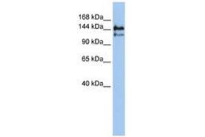 Image no. 1 for anti-Transcription Elongation Factor SPT5 (SUPT5H) (AA 396-445) antibody (ABIN6740366)