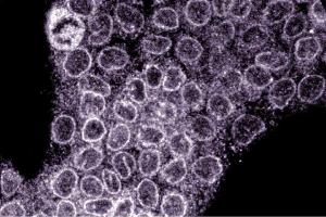 Immunofluorescence staining of A431 cells (Human epithelial carcinoma, ATCC CRL-1555).