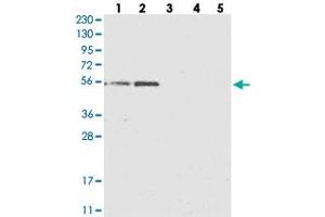 Western blot analysis of Lane 1: RT-4, Lane 2: U-251 MG, Lane 3: Human Plasma, Lane 4: Liver, Lane 5: Tonsil with KCTD20 polyclonal antibody  at 1:250-1:500 dilution. (KCTD20 antibody)