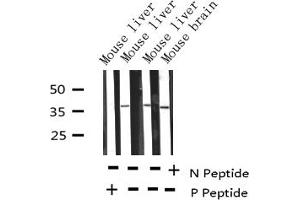 Western Blotting (WB) image for anti-Replication Protein A2, 32kDa (RPA2) (pThr21) antibody (ABIN6255629)