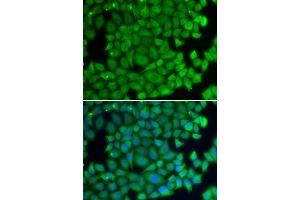 Immunofluorescence analysis of U2OS cells using HSPB2 antibody (ABIN6131082, ABIN6142054, ABIN6142055 and ABIN6219505). (HSPB2 antibody  (AA 1-182))