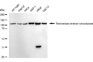 Western blotting analysis using Telomerase reverse transcriptase antibody (ABIN7800528).