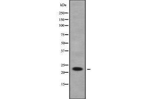 Western blot analysis of RAB1B using COLO205 whole cell lysates (RAB1B antibody  (Internal Region))