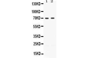 Western blot analysis of ZAP70 expression in JURKAT whole cell lysates ( Lane 1) and CEM whole cell lysates ( Lane 2). (ZAP70 antibody  (Middle Region))