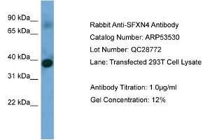 WB Suggested Anti-SFXN4  Antibody Titration: 0. (Sideroflexin 4 antibody  (N-Term))
