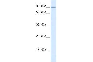 WB Suggested Anti-ZNF537 Antibody Titration:  0. (TSHZ3 antibody  (Middle Region))