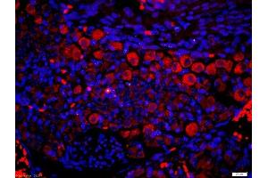 Paraformaldehyde-fixed, paraffin embedded mouse embryo tissue, Antigen retrieval by boiling in sodium citrate buffer(pH6) for 15min, Block endogenous peroxidase by 3% hydrogen peroxide for 30 minutes, Blocking buffer (normal goat serum) at 37°C for 20min, Antibody incubation with Rabbit Anti-P2Y9 Polyclonal Antibody, Unconjugated  at 1:200 overnight at 4°C, followed by a conjugated secondary and DAB staining (LPAR4 antibody  (AA 175-270))