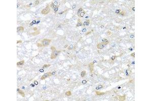 Immunohistochemistry of paraffin-embedded Rat brain using RPLP1 Polyclonal Antibody at dilution of 1:100 (40x lens). (RPLP1 antibody)