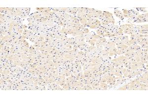 Detection of DBI in Human Cardiac Muscle Tissue using Polyclonal Antibody to Diazepam Binding Inhibitor (DBI) (Diazepam Binding Inhibitor antibody  (AA 1-104))