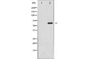 Western Blotting (WB) image for anti-Checkpoint Kinase 2 (CHEK2) (pThr383) antibody (ABIN1844022) (CHEK2 antibody  (pThr383))