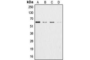 Western blot analysis of AKT expression in HeLa (A), HEK293T (B), NIH3T3 (C), H9C2 (D) whole cell lysates. (AKT1 antibody  (Center))